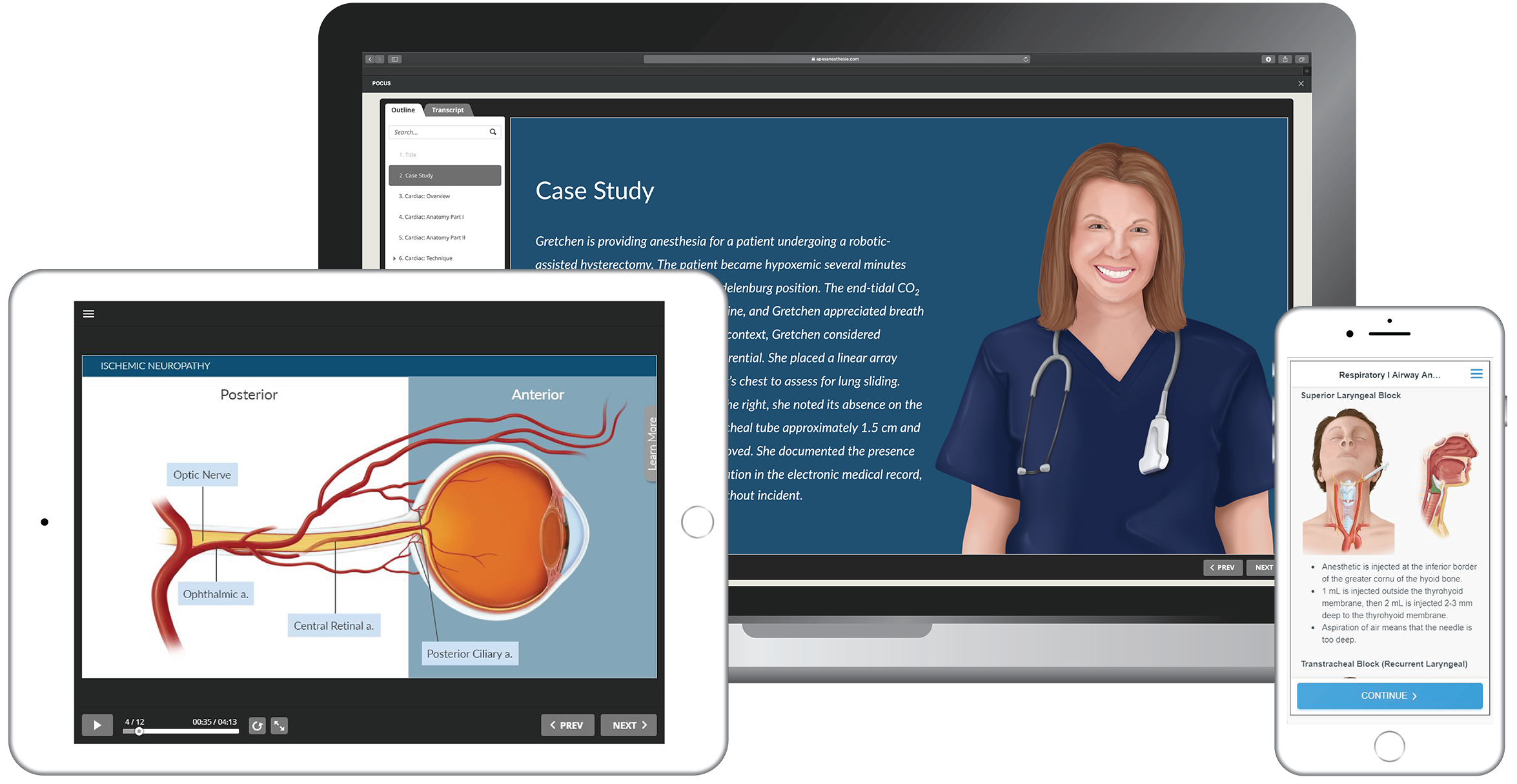 Apex Anesthesia allows CRNAs and students to learn the CPC Core Modules in several mediums including by video, streaming audio and printable PDFs. 