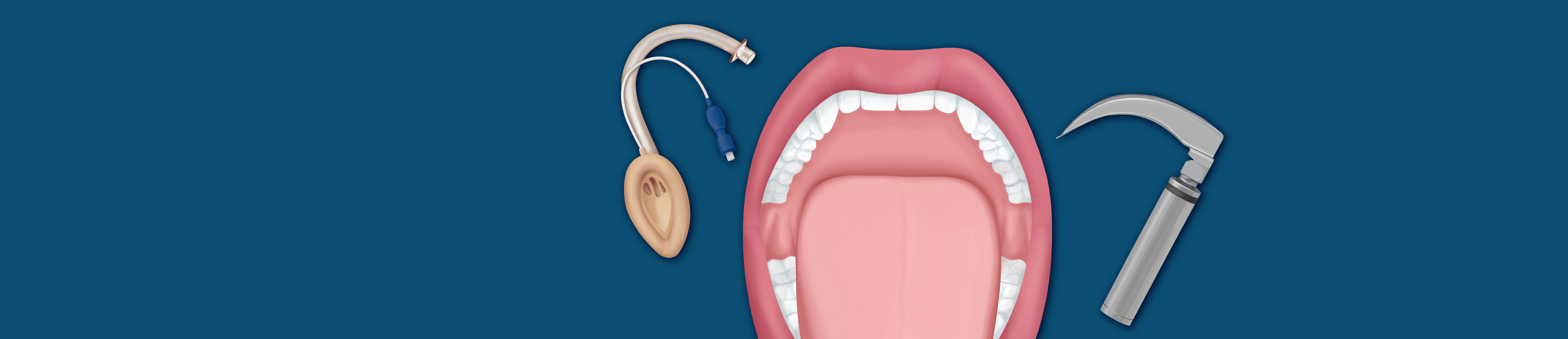 2022 ASA Difficult Airway Algorithm: What’s New?