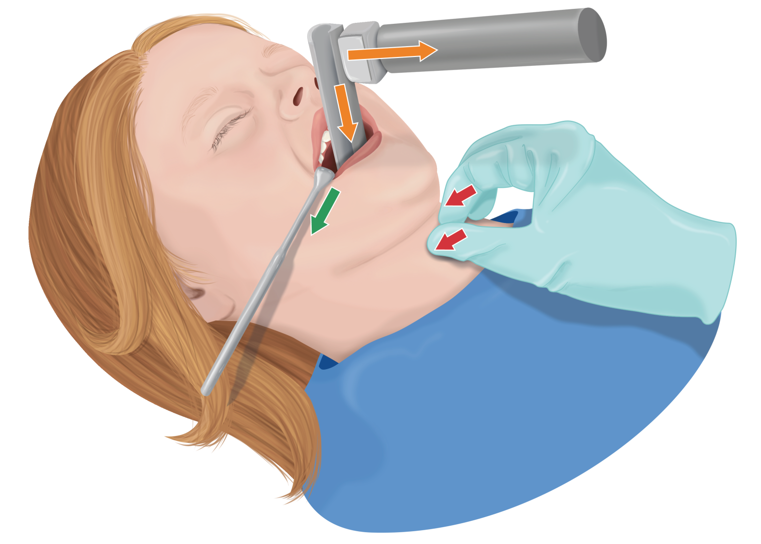 Under Pressure The Application of Cricoid Pressure in Pediatrics