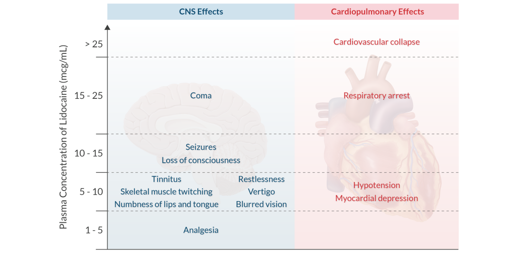 A chart showing the CNS Effects and Cardiopulmonary Effects of local anesthetic systemic toxicity (LAST).