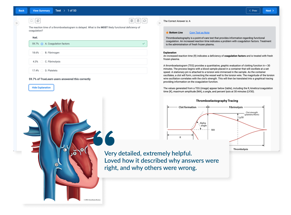 NCE/SEE question bank example practice question with image of heart valves