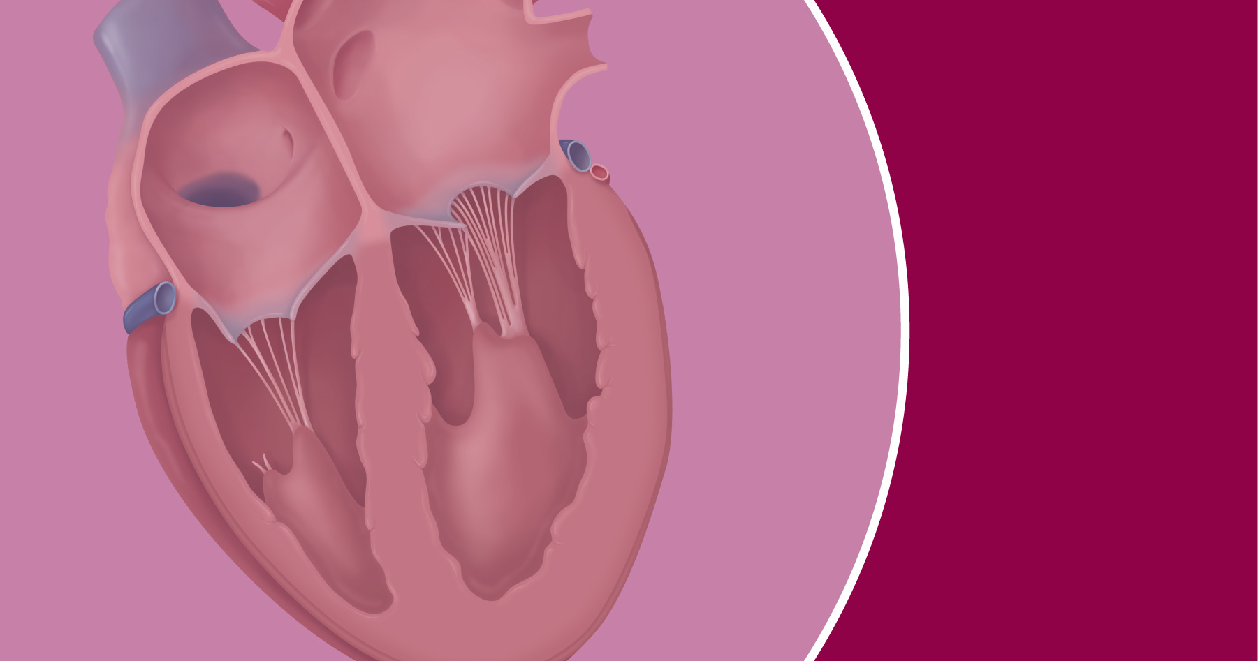 Cross-section illustration of a human heart showing chambers, valves, and chordae tendineae.