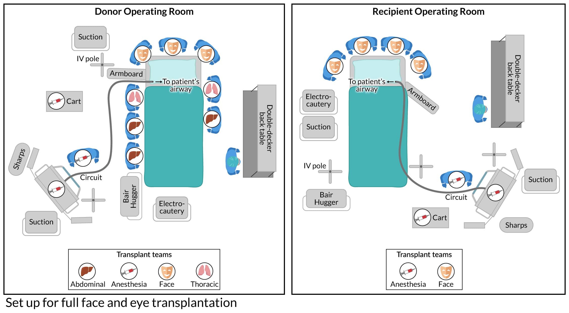 drone view of donor and recipient operating rooms
