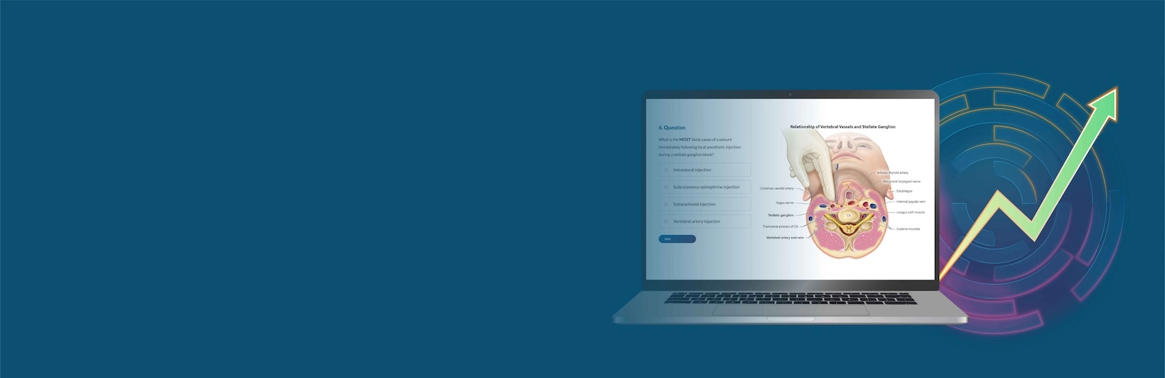 CE mastery question on a laptop screen