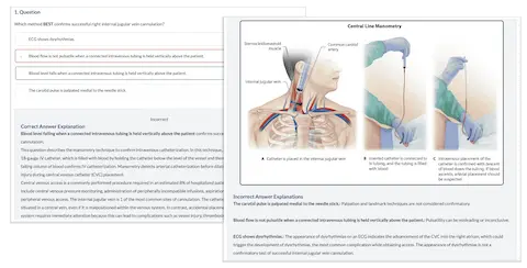 detailed explanation of a quiz question