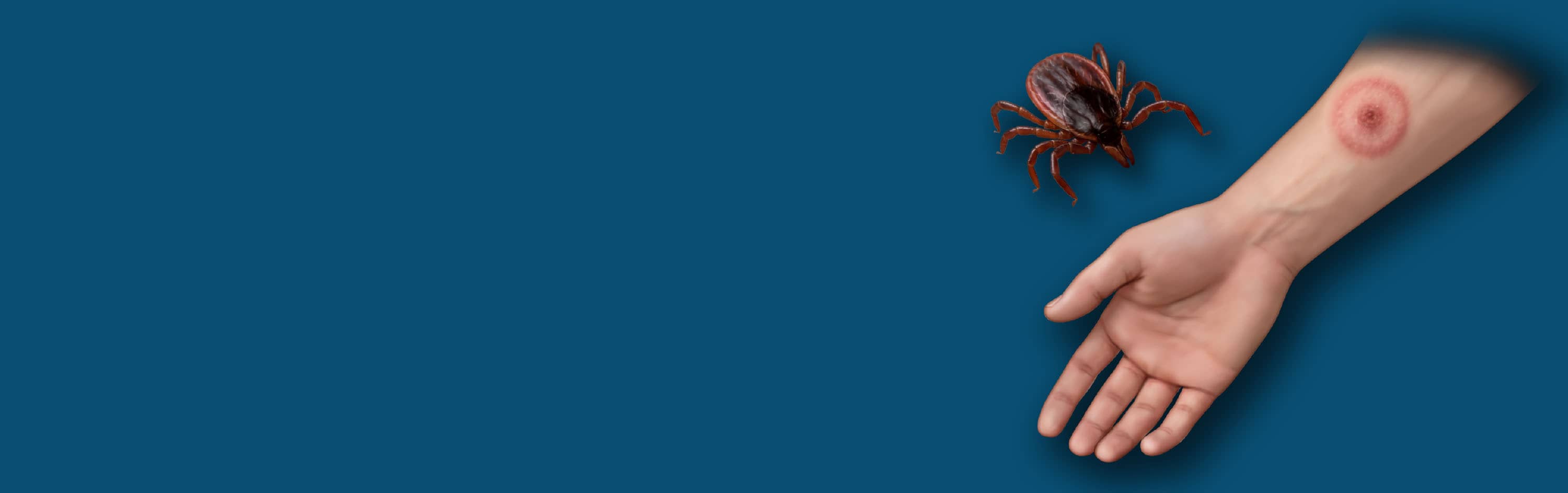 research on lyme disease